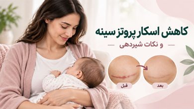 بیماری کاهش اسکارهای بعد عمل پروتز سینه و نکات شیردهی